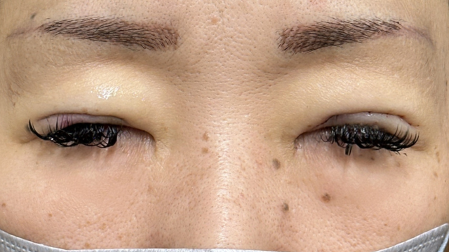 手术前的状态 其一