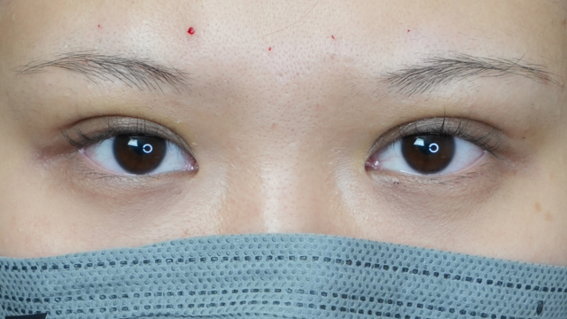 Postoperative Condition Part 1