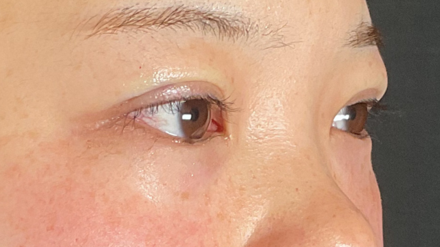 Postoperative Condition Part 1