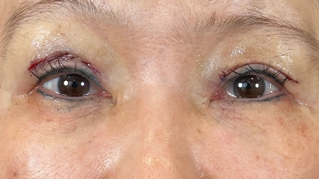 Postoperative Condition Part 1