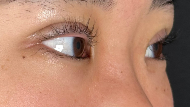 Postoperative Condition Part 1