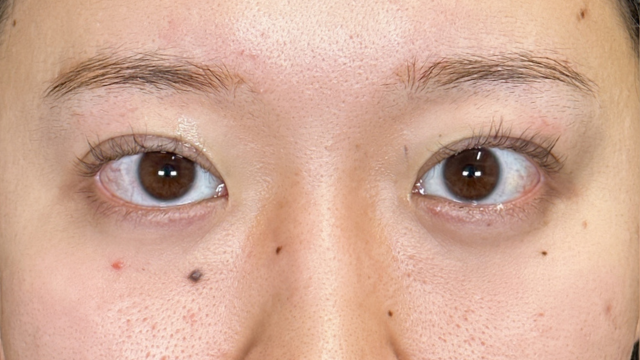 Postoperative Condition Part 1