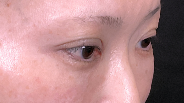 Postoperative Condition Part 1