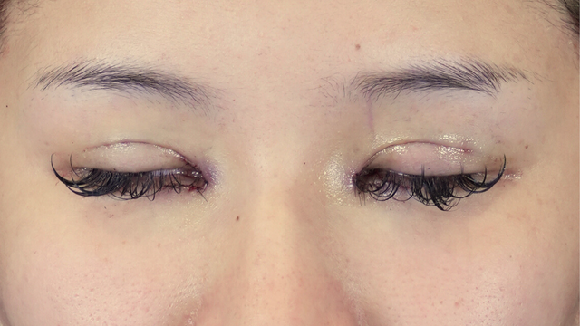 Postoperative Condition Part 1