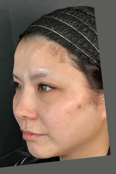 Postoperative Condition Part 1