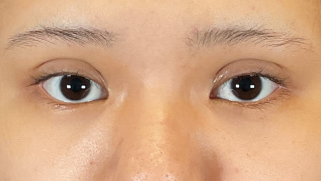 Postoperative Condition Part 1