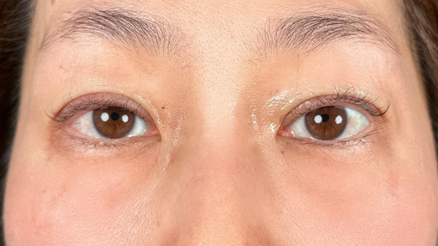 Postoperative Condition Part 1