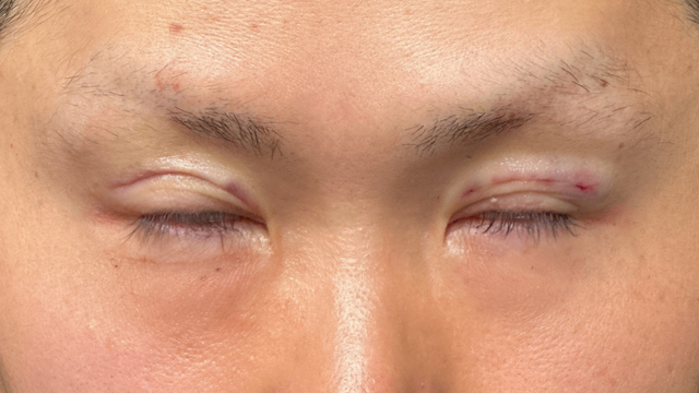 Postoperative Condition Part 1