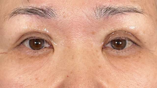 Postoperative Condition Part 1