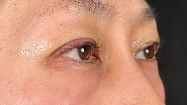 Postoperative Condition Part 1