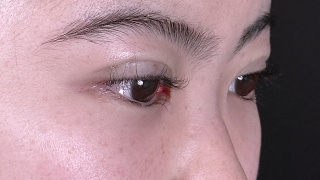 Postoperative Condition Part 1