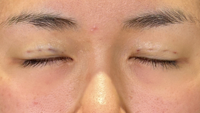 Postoperative Condition Part 1