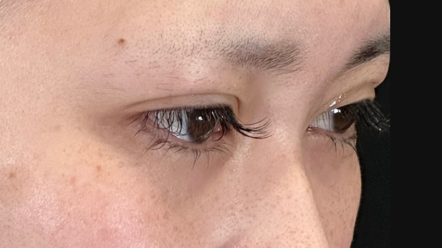 Postoperative Condition Part 1