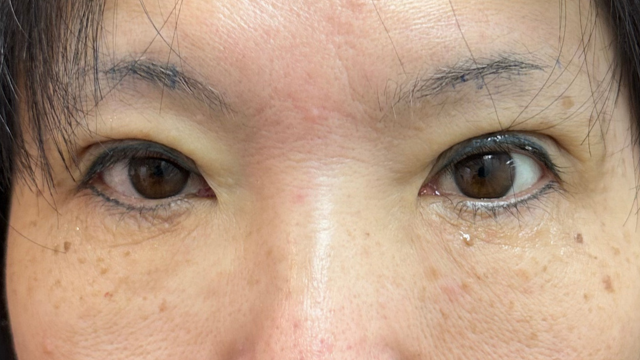 Postoperative Condition Part 1