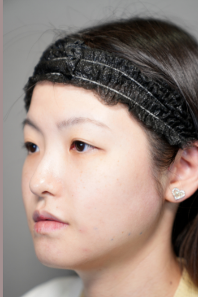 Postoperative Condition Part 1