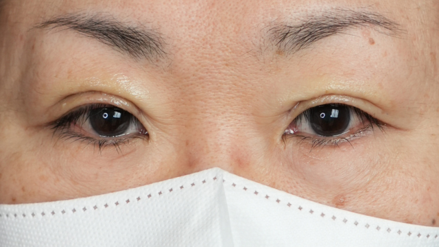 Postoperative Condition Part 1