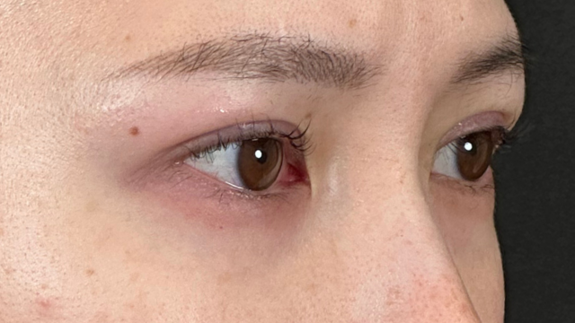 Postoperative Condition Part 1