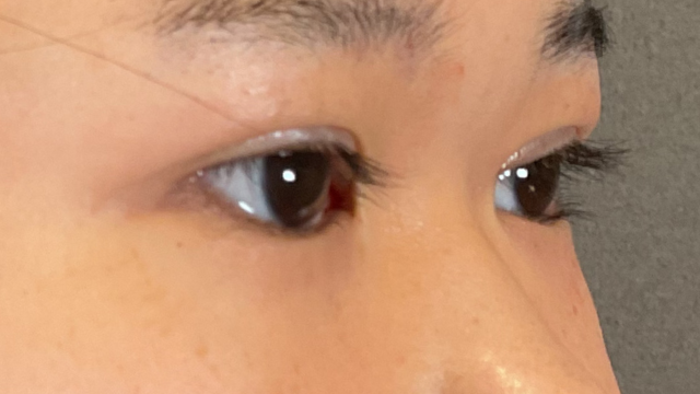 Postoperative Condition Part 1