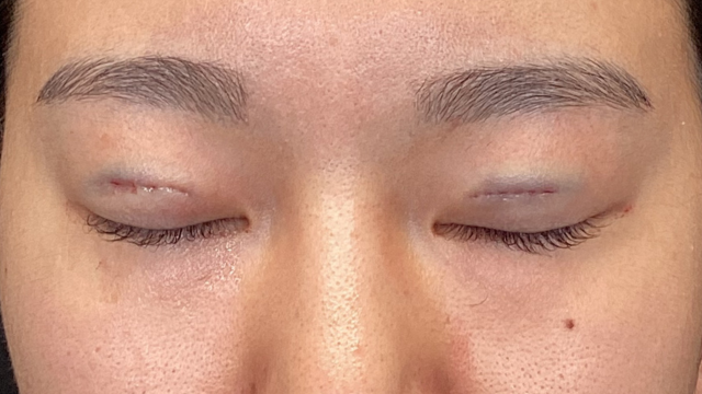 Postoperative Condition Part 1