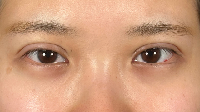 Postoperative Condition Part 1