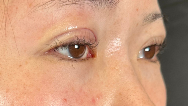 Postoperative Condition Part 1