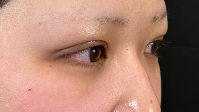 Postoperative Condition Part 1