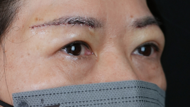 Postoperative Condition Part 1