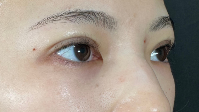 Postoperative Condition Part 1