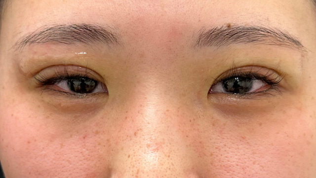 Postoperative Condition Part 1