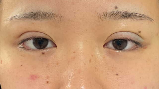 Postoperative Condition Part 1