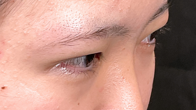 Postoperative Condition Part 1