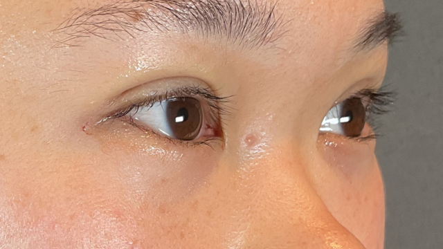 Postoperative Condition Part 1