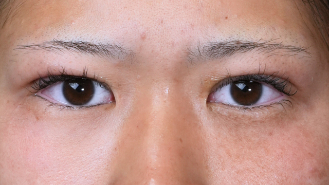 Postoperative Condition Part 1