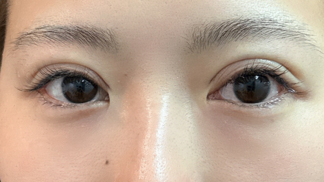 Postoperative Condition Part 1