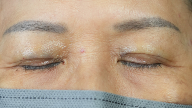 Postoperative Condition Part 1