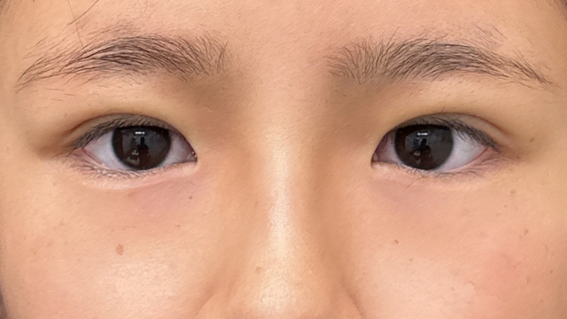 Postoperative Condition Part 1