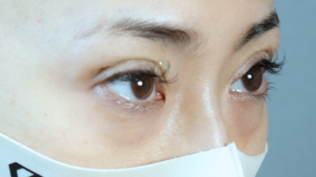 Postoperative Condition Part 1