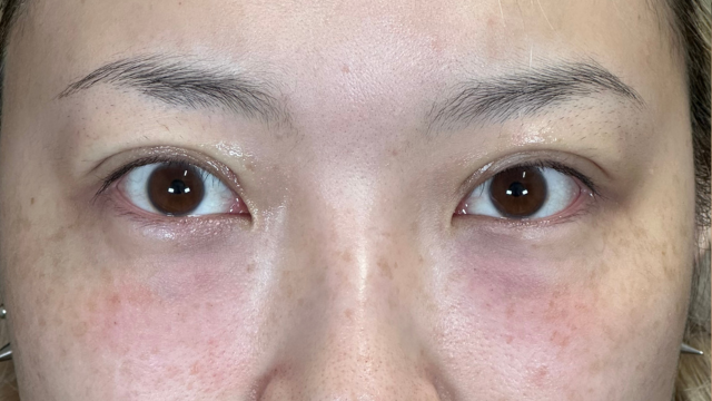 Postoperative Condition Part 1