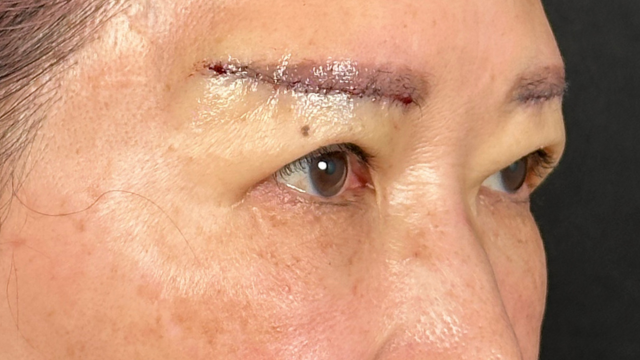 Postoperative Condition Part 1