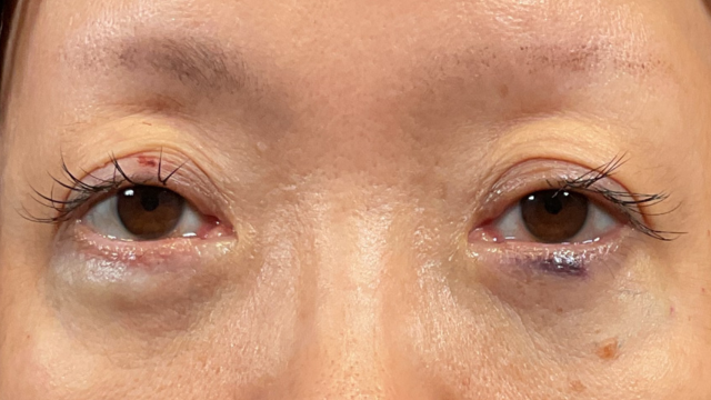 Postoperative Condition Part 1