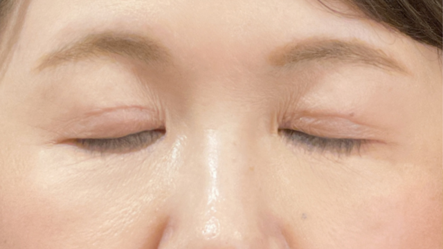 Postoperative Condition Part 1