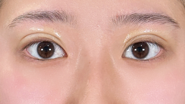 Postoperative Condition Part 1