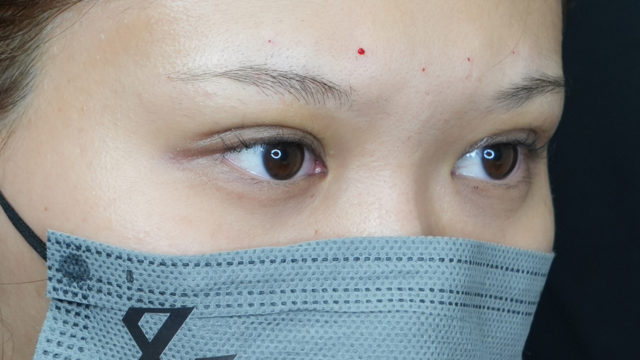 Postoperative Condition Part 1