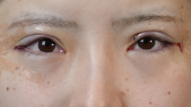 Postoperative Condition Part 1