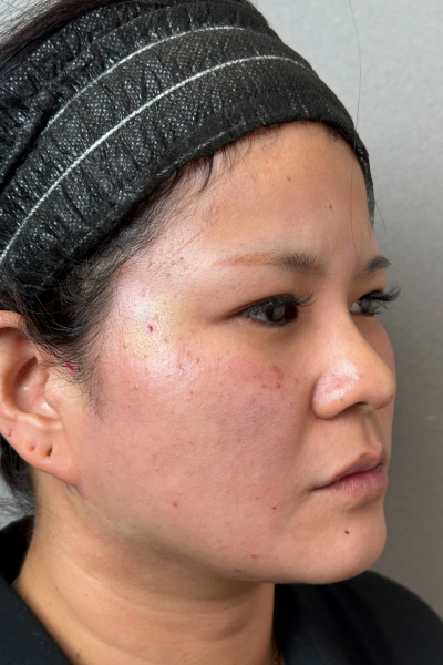 手術前の状態 その1