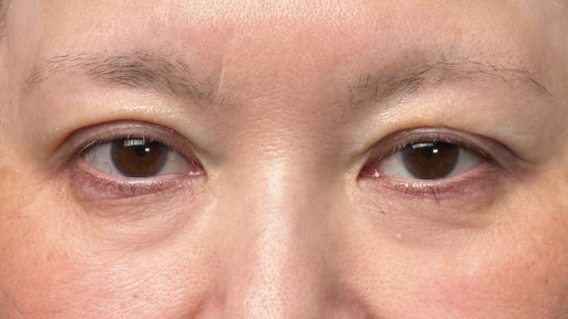 Postoperative Condition Part 1