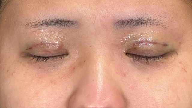 Postoperative Condition Part 1