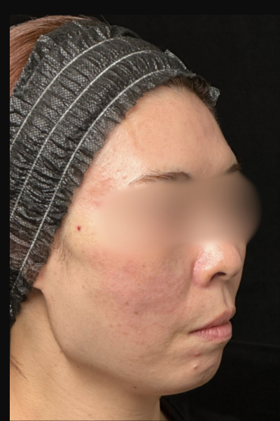 Postoperative Condition Part 1