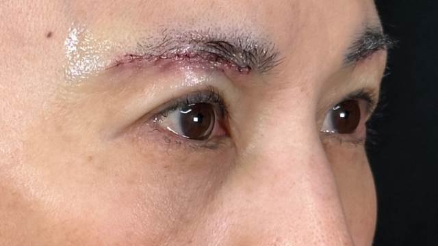 Postoperative Condition Part 1