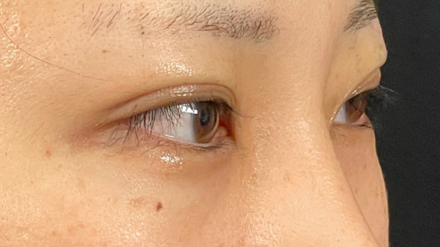 Postoperative Condition Part 1